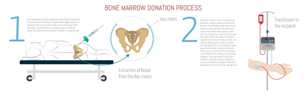 病気の噂？白血病患者を救ったドナー経験